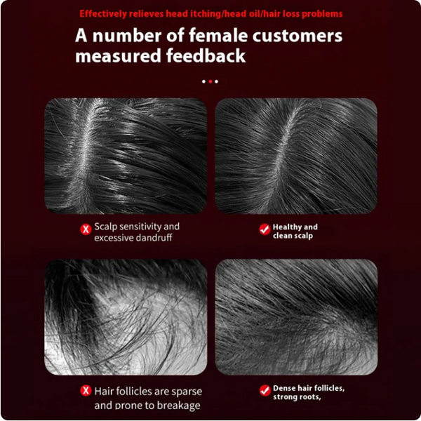 RootFlow™ Scalp Massager for Hair Growth & Relaxation.